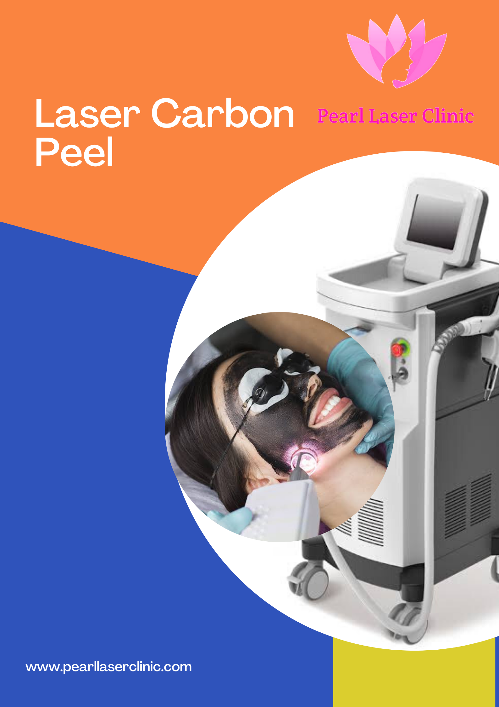 Charcoal Laser peel - Pearl Laser Clinic